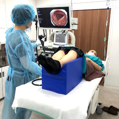 実際の大腸内視鏡検査の様子のイメージ画像