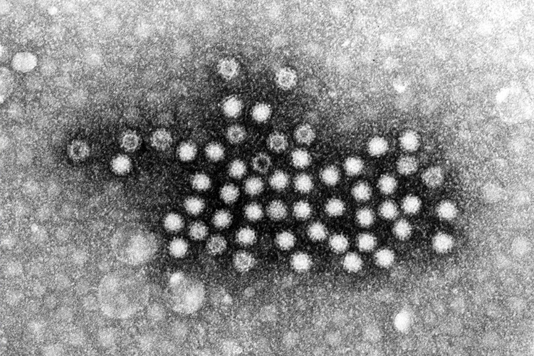 感染性のイメージ画像