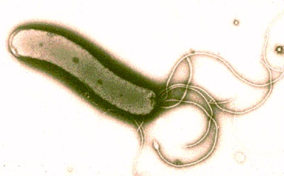 ピロリ菌イメージ画像