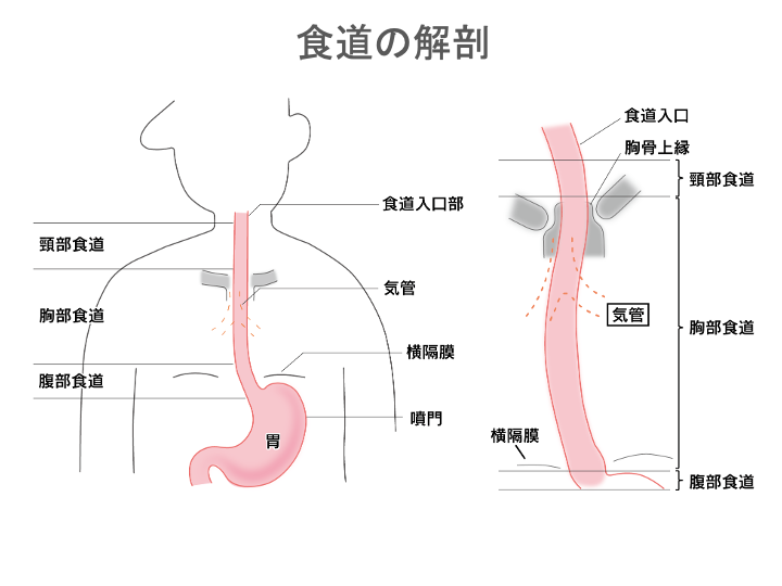 食道がんとは