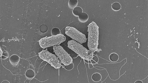 腸管出血性大腸菌感染症（EHEC）とは？