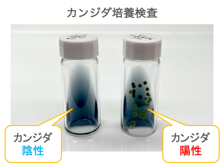 カンジダ培養検査