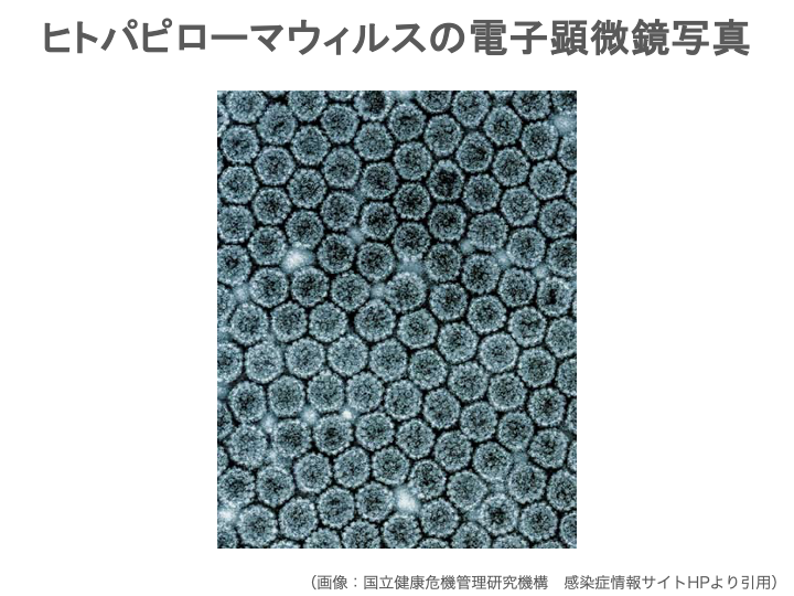 肛門ヘルペス感染症とは?