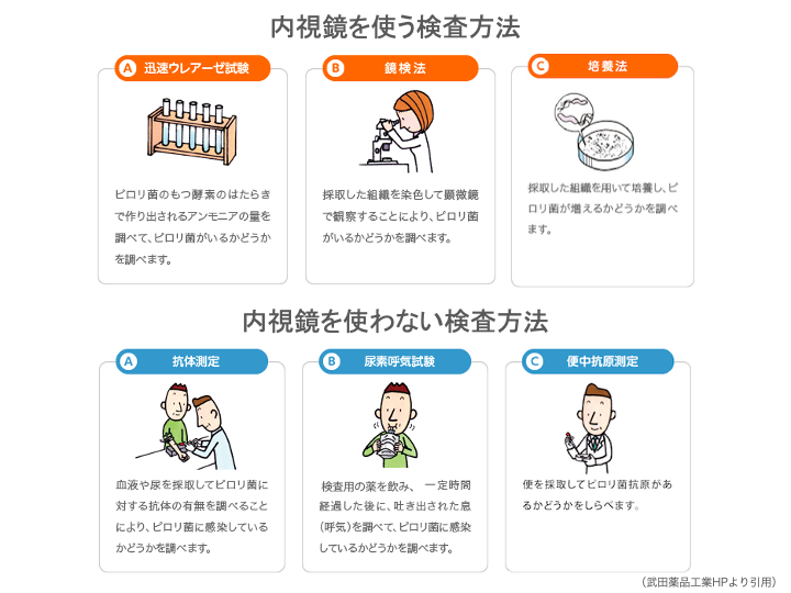 ピロリ菌の検査